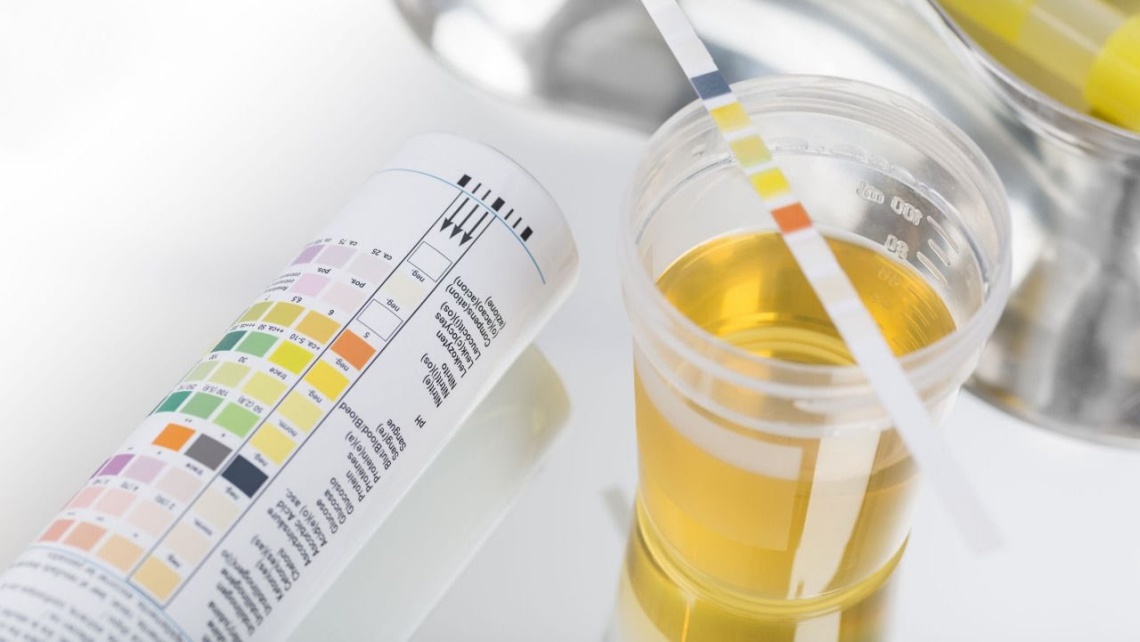 Анализ мочи у кошек и собак в Алматы 